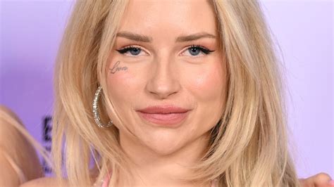 Lottie Moss lässt sich Gesichtstattoo entfernen